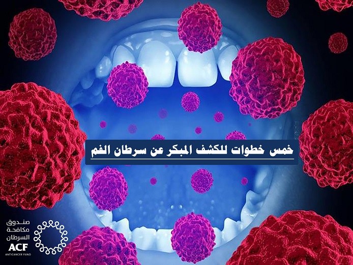 خمس خطوات للكشف المبكر عن سرطان الفم